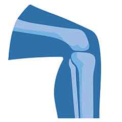 Sức khỏe xương khớp