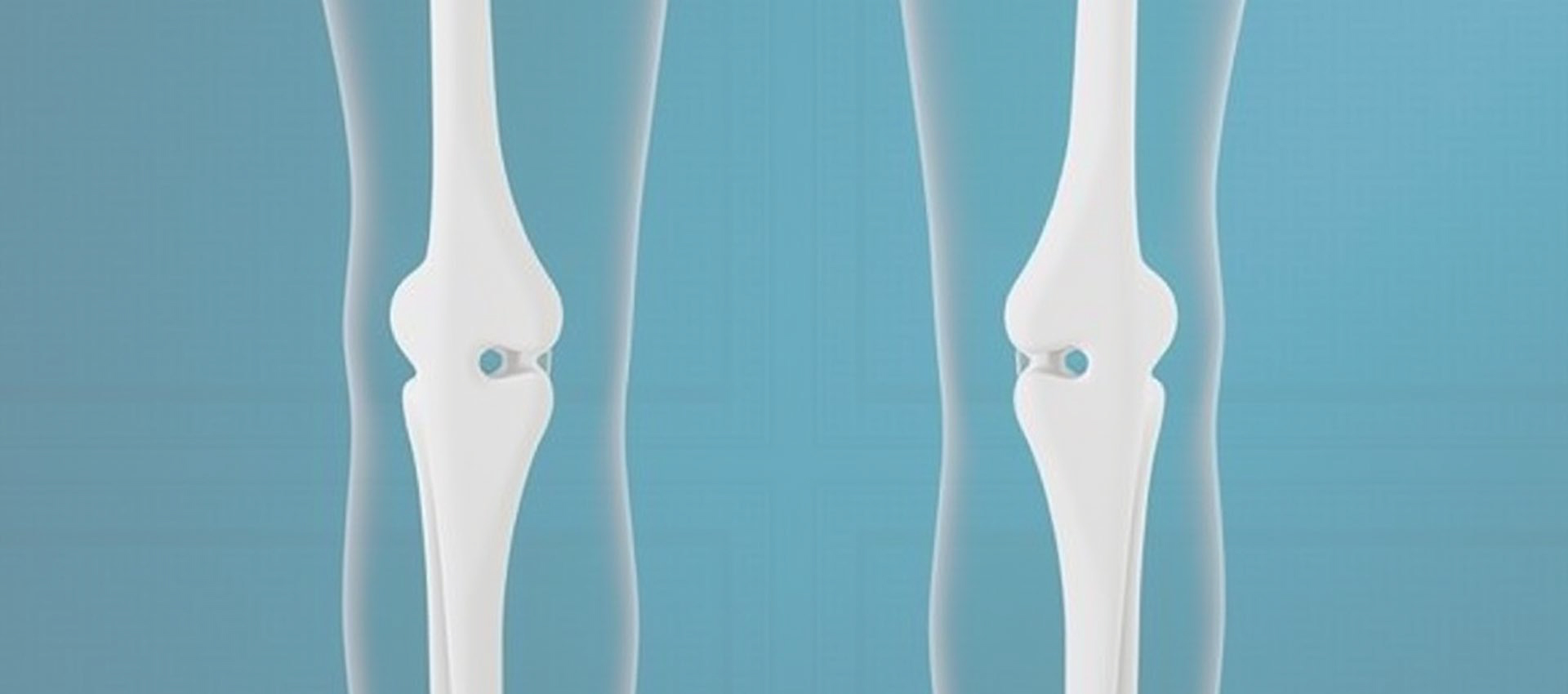 Liposomal Vitamin D3