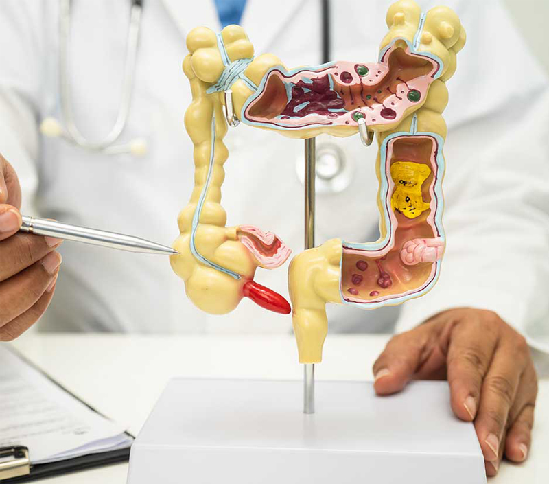 Lý tưởng cho việc trao đổi chất và chăm sóc sức khỏe tiêu hóa