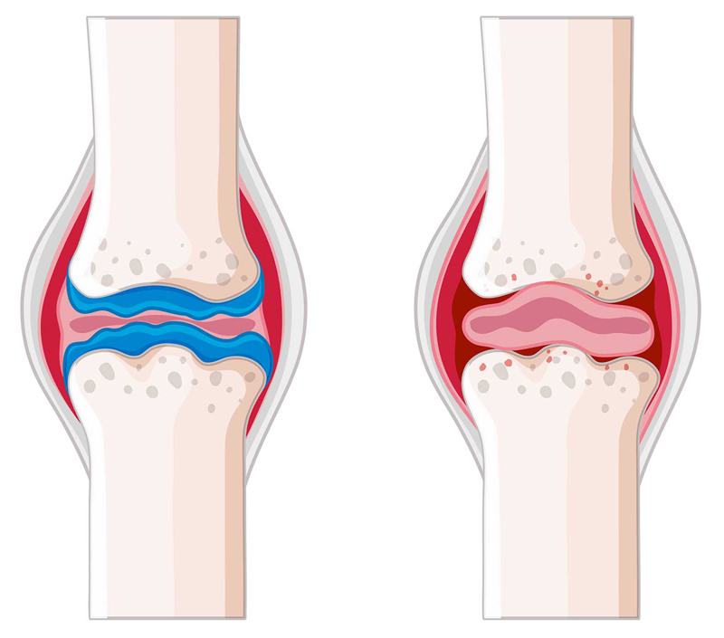 Tăng cường sức khỏe xương và tim mạch
